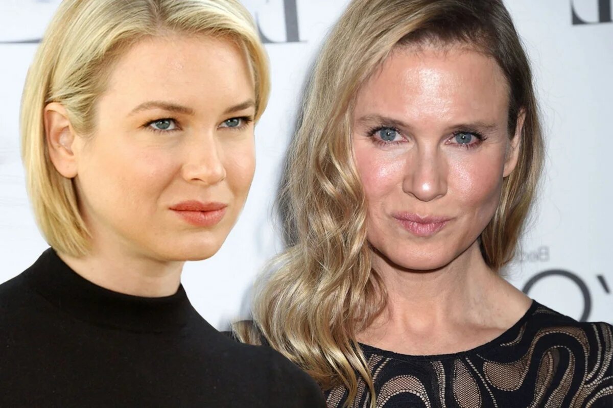 Результаты работы пластического хирурга над лицом Рене Зеллвегер 