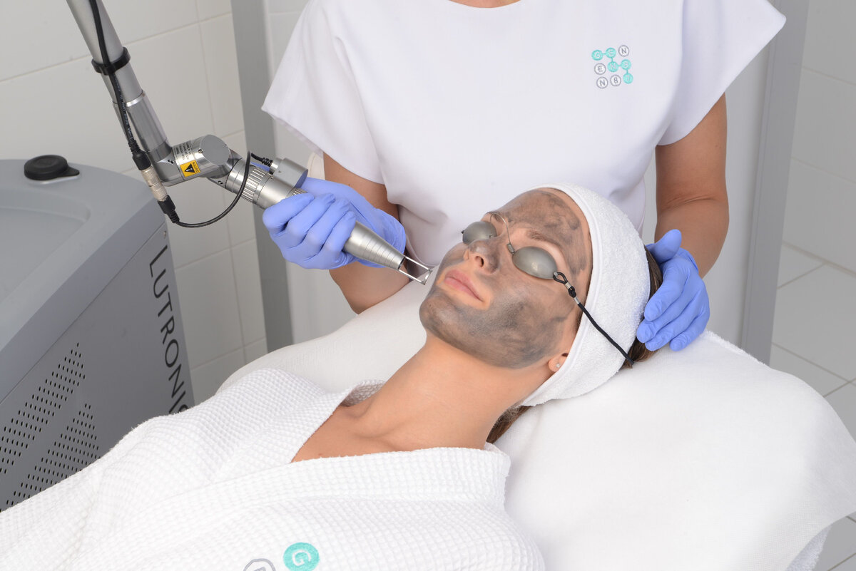 Карбоновый пилинг. Источник фото - gen87.ru