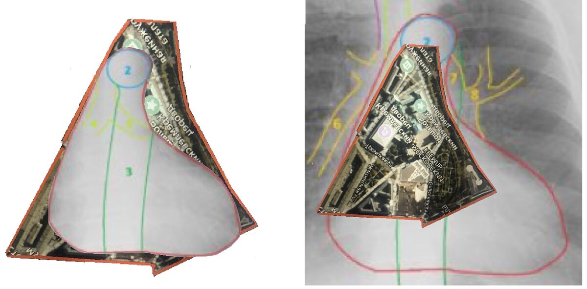 Тень сердца человека на фоне Кремля (вид из космоса)  и наоборот
