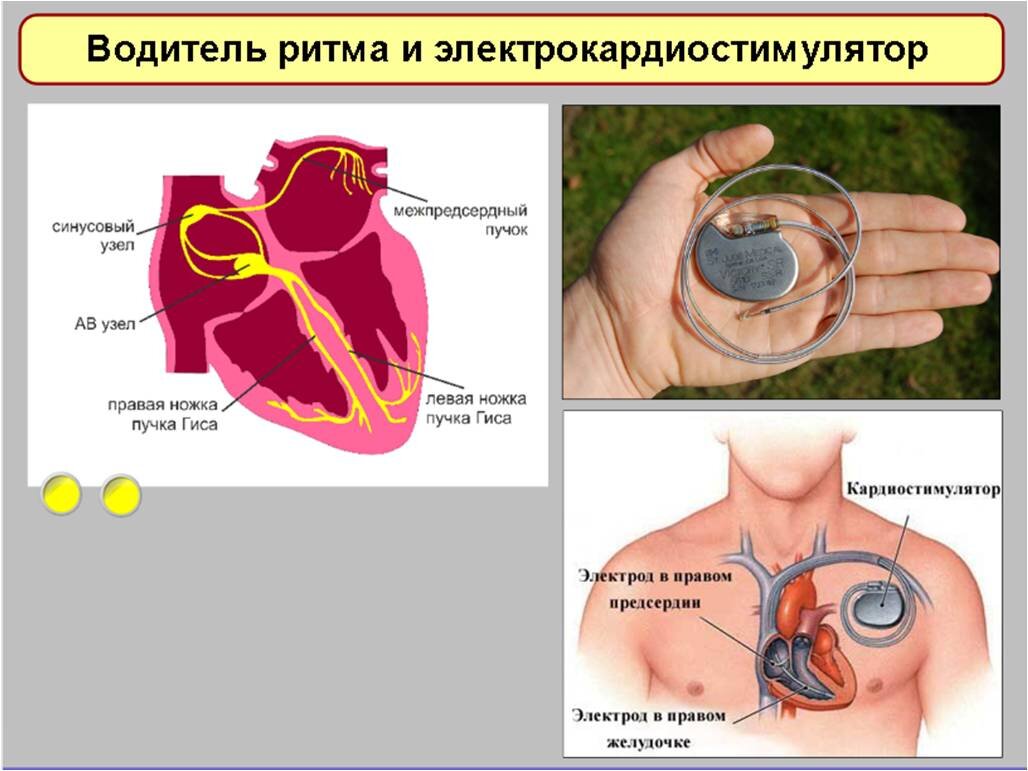 Четырехкамерный срез сердца