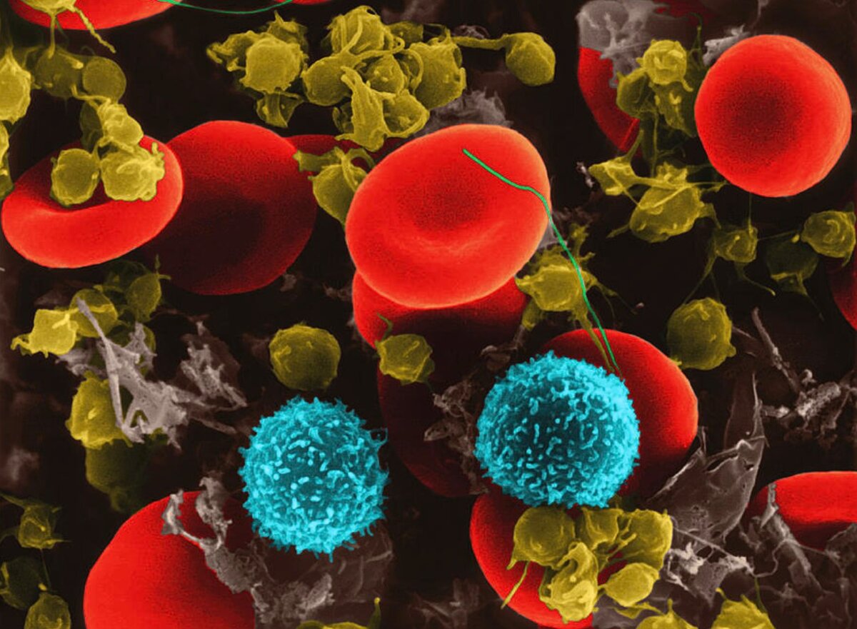 Красные кровяные клетки. Человеческие эритроциты, два Т-лимфоцита и тромбоциты, составная цветная сканирующая электронная микрофотография (SEM) Красные кровяные тельца (эритроциты) или эритроциты являются наиболее распространенным типом клеток крови у позвоночных. Они участвуют в доставке кислорода к тканям тела. Лимфоциты (лейкоциты, белые кровяные тельца) участвуют в специфическом иммунном ответе. Пре-Т-клетки циркулируют в крови перед миграцией в тимус, где они развиваются в специализированные клетки (хелперные Т-клетки и Т-клетки-киллеры), которые способны идентифицировать антигены и инфицированные тканевые клетки. Тромбоциты - это фрагменты клеток крови, которые играют важную роль в свертывании крови и заживлении ран.