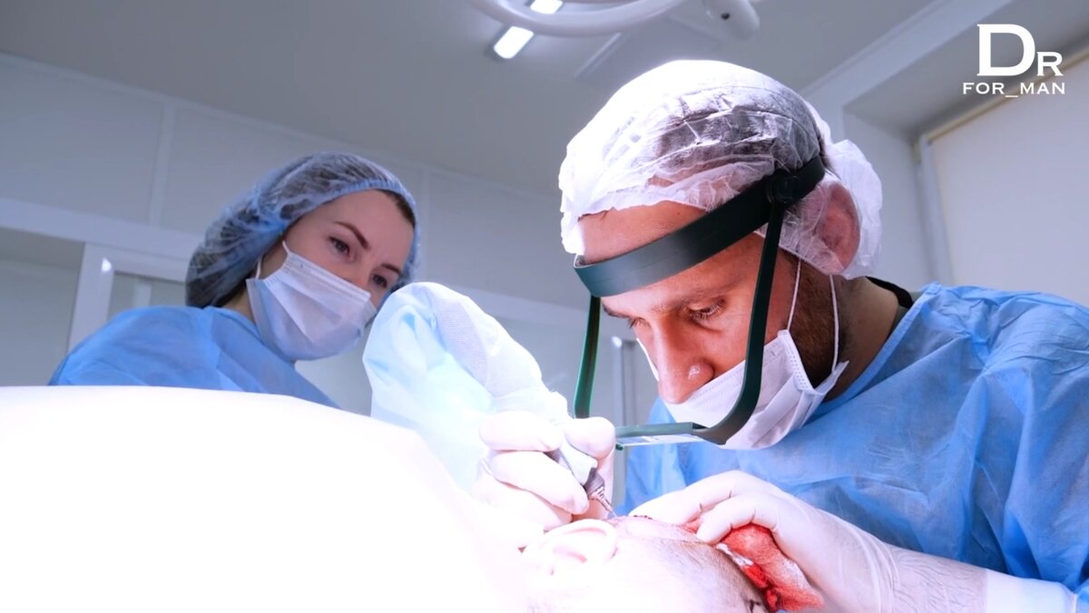 Услуги по пересадке бороды