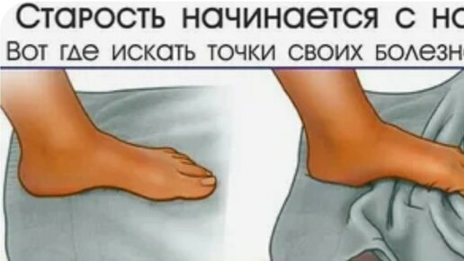 Как вправить голеностоп. Способы вправления подвывихов голеностопного сустава – Медицинский портал Бандажи и ортезы на голеностоп: кому и когда их стоит использовать. Как укрепить голеностоп, разработать подъем дома и в зале