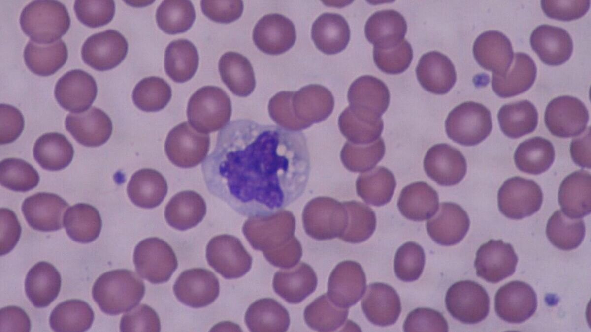    Моноцит в мазке кровиCC BY-SA 4.0 / Bobjgalindo /