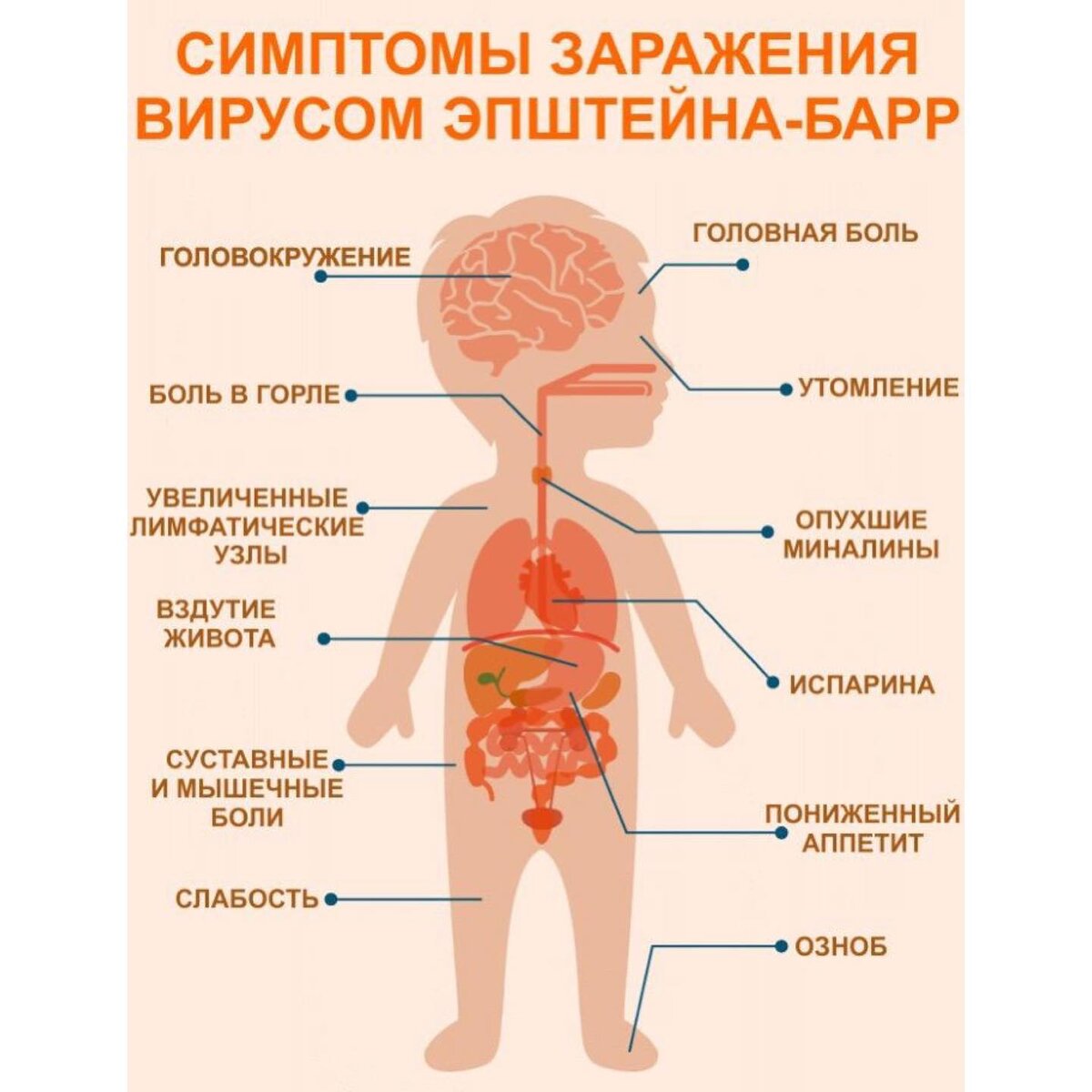 Эпштейн барра лечение. Вирус Эпштейна-Барра симптомы. Вирус Эпштейна-Барр у детей симптомы. Эпштейн-Барр вирус симптомы. Вирус Эпштей бара симптомы.