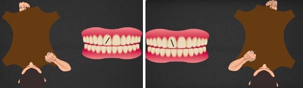 Обработка кожи