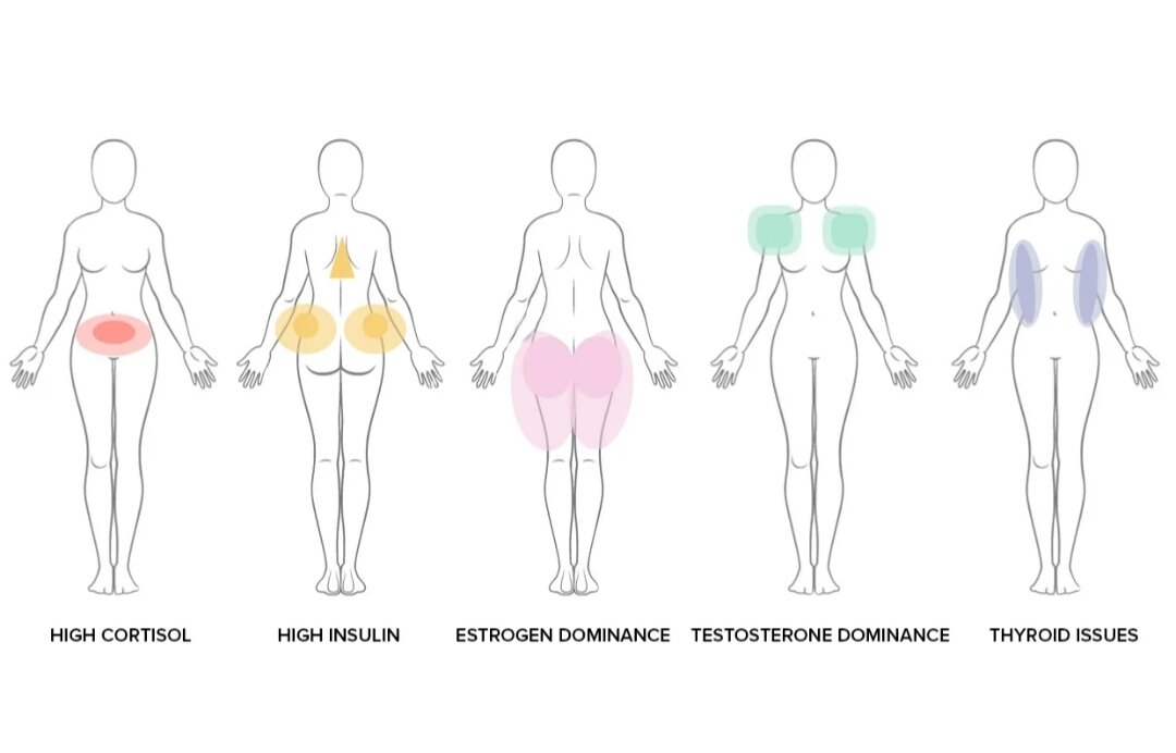 Гормональный вес у женщины что делать. Эстрогеновый Тип фигуры. Типы отложения жира. Проблемные зоны фигуры. Проблемные места женской фигуры.