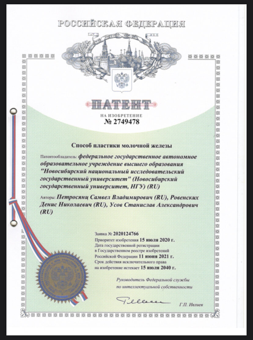 Патент на изобретение «способ пластики молочной железы»