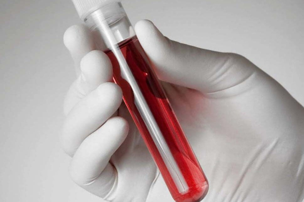 Ссылка на истоничк изображения: https://clck.ru/32XcmX