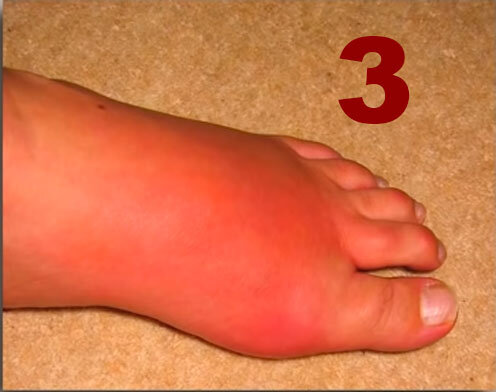 Такой у меня была стопа. 