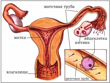 Заблудившаяся беременность