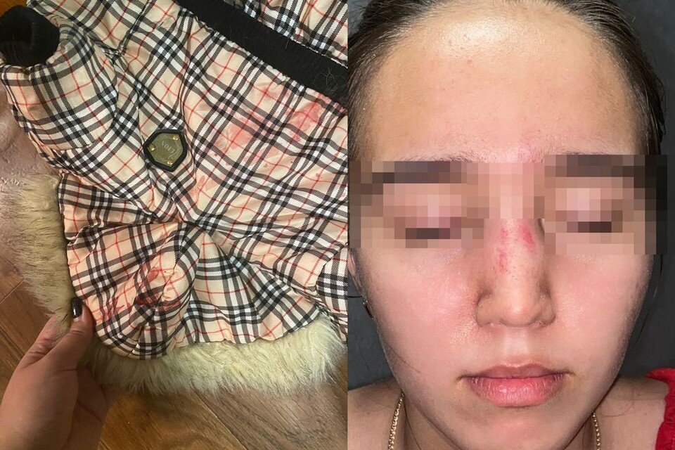     Мужчина сломал девочке нос, а его собака покусала ее йорка. Фото: предоставлено семьей пострадавшей