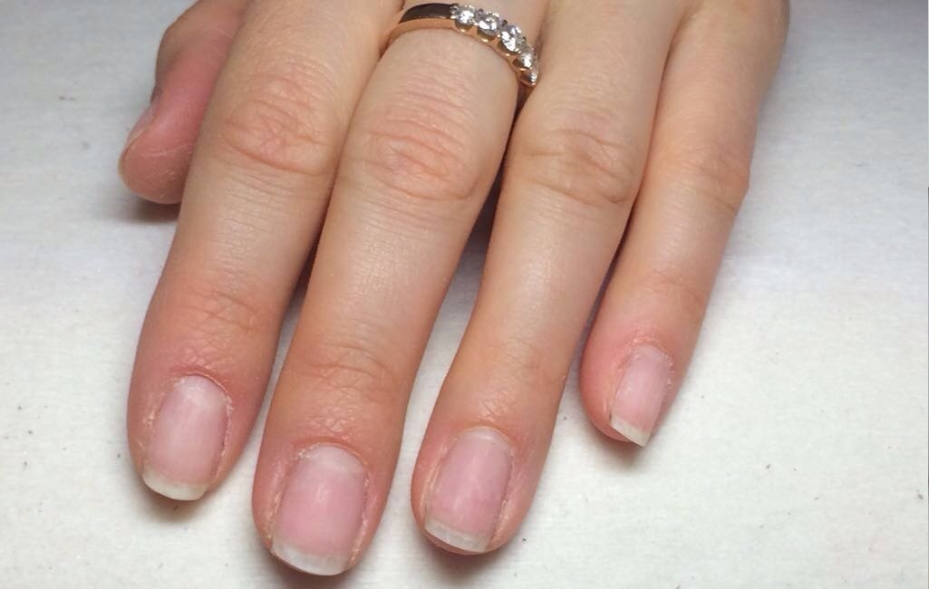 Я сняла ногти. Женский маникюр. Снятие нарощенных ногтей. Обрезной маникюр гель-лак шеллак. Ногти снятие нарощенных ногтей.