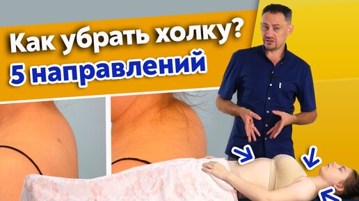 Почему появляется вдовий горбик? Как избавиться от холки?