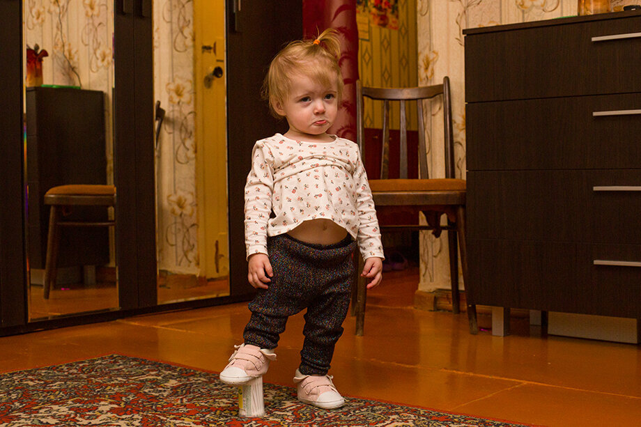 Разница в длине ног у Миры составляет 5 сантиметров. Фото: Максим Конанков/Octagon.Media