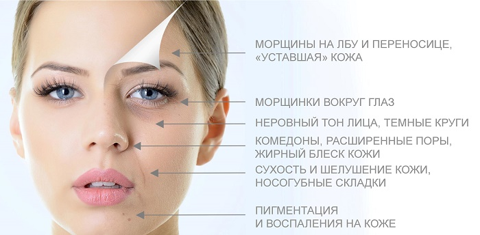 Поскольку у меня нет особых проблем с акне, о глубоких видах очищения я не задумывалась. Может, оно мне будет и на пользу, но просто нет какой-то необходимости.