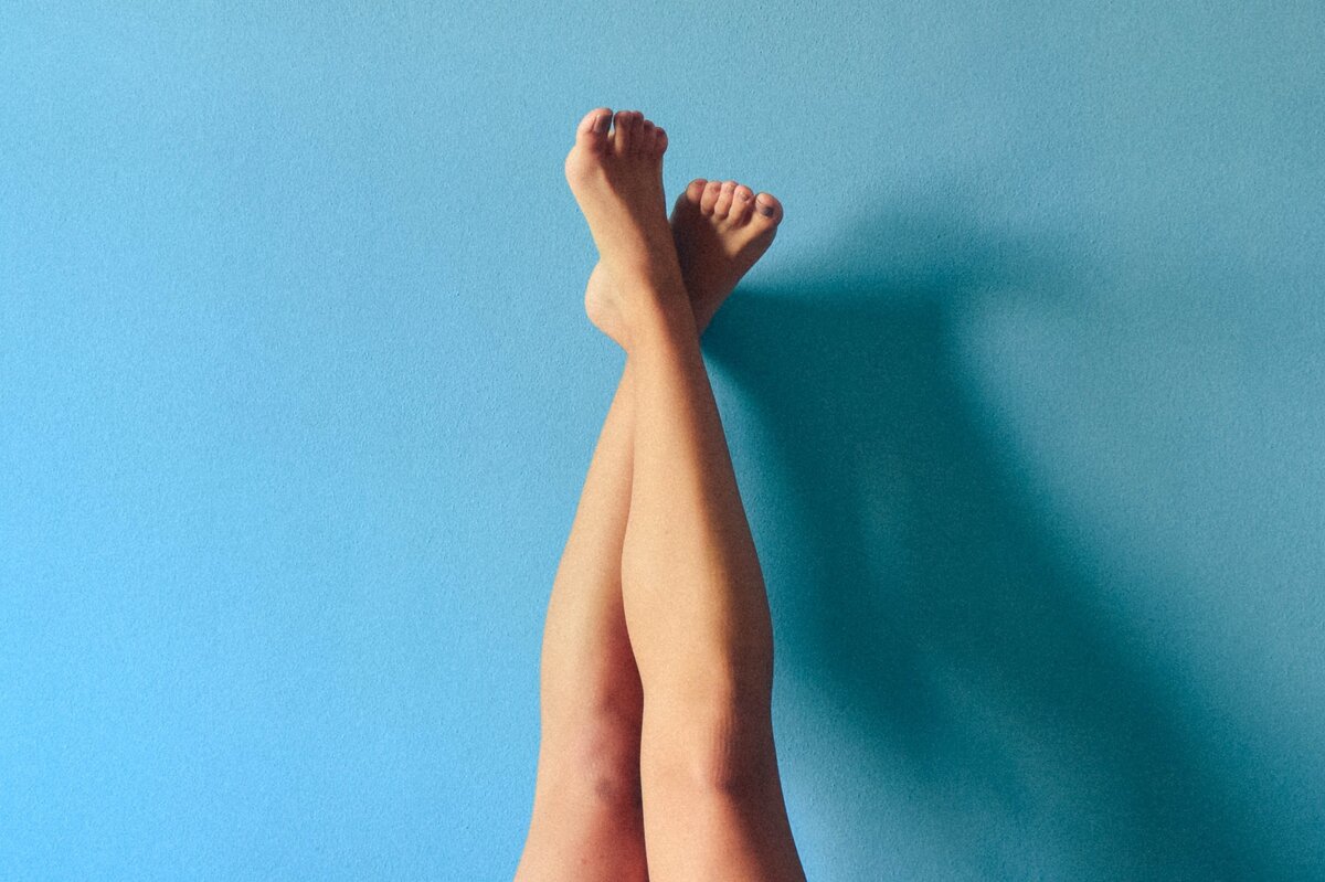     Сосудистые звёздочки и варикоз, как с этим жить?