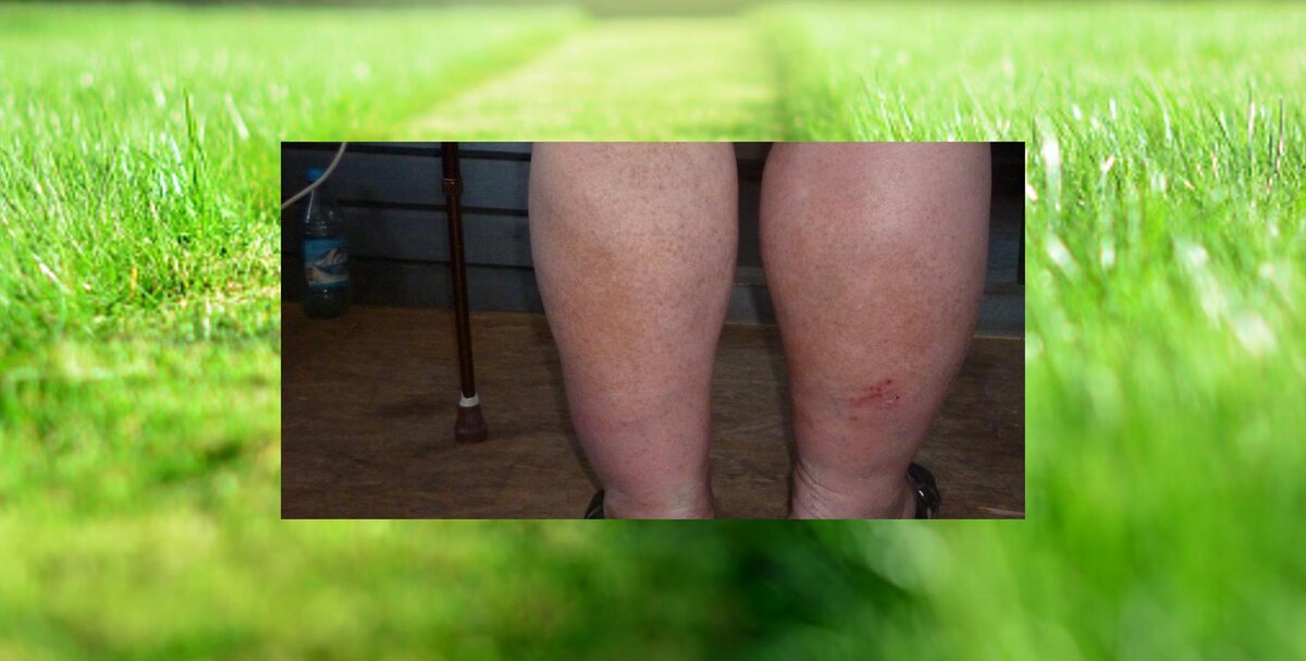 Старость и болезнь никого не щадят.