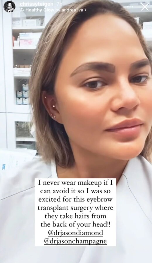 Крисси Тейген, @chrissyteigen