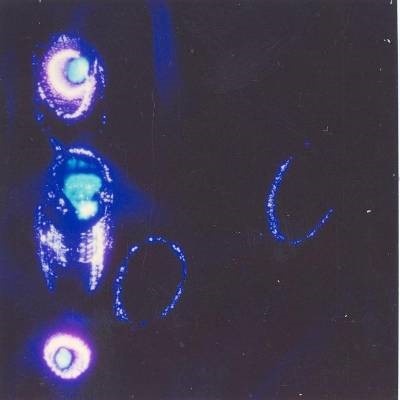 Кадры I и  II – исходное поле Владимира 16 лет. Кадр III. Владимир прочёл три молитвы. Кадр IV. Мама Владимира прочла три молитвы о благополучии сына и мысленно направила в его поле Космический Знак – Знаковый Храм. Рядом с замкнувшейся ауры появился синий луч и цветной плазмоид.