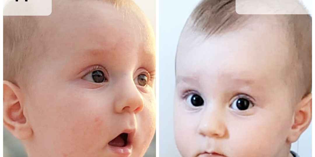 Открытый рот у ребенка