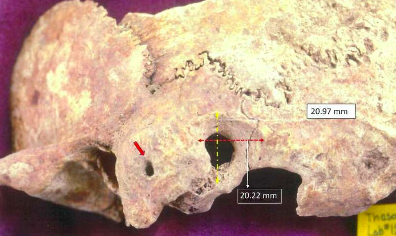 Фрагмент черепа мужчины. Фото: Anagnostis P. Agelarakis / Adelphi University