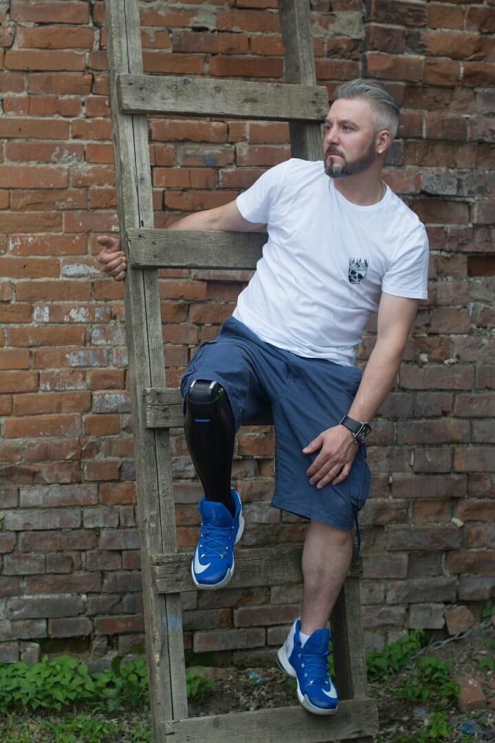 Денис Калинин протезист и пациент компании Орто-Инновации за три месяца до своего двадцатилетия получил железнодорожную травму, этот случай изменил его жизнь полностью. Он остался без ноги.