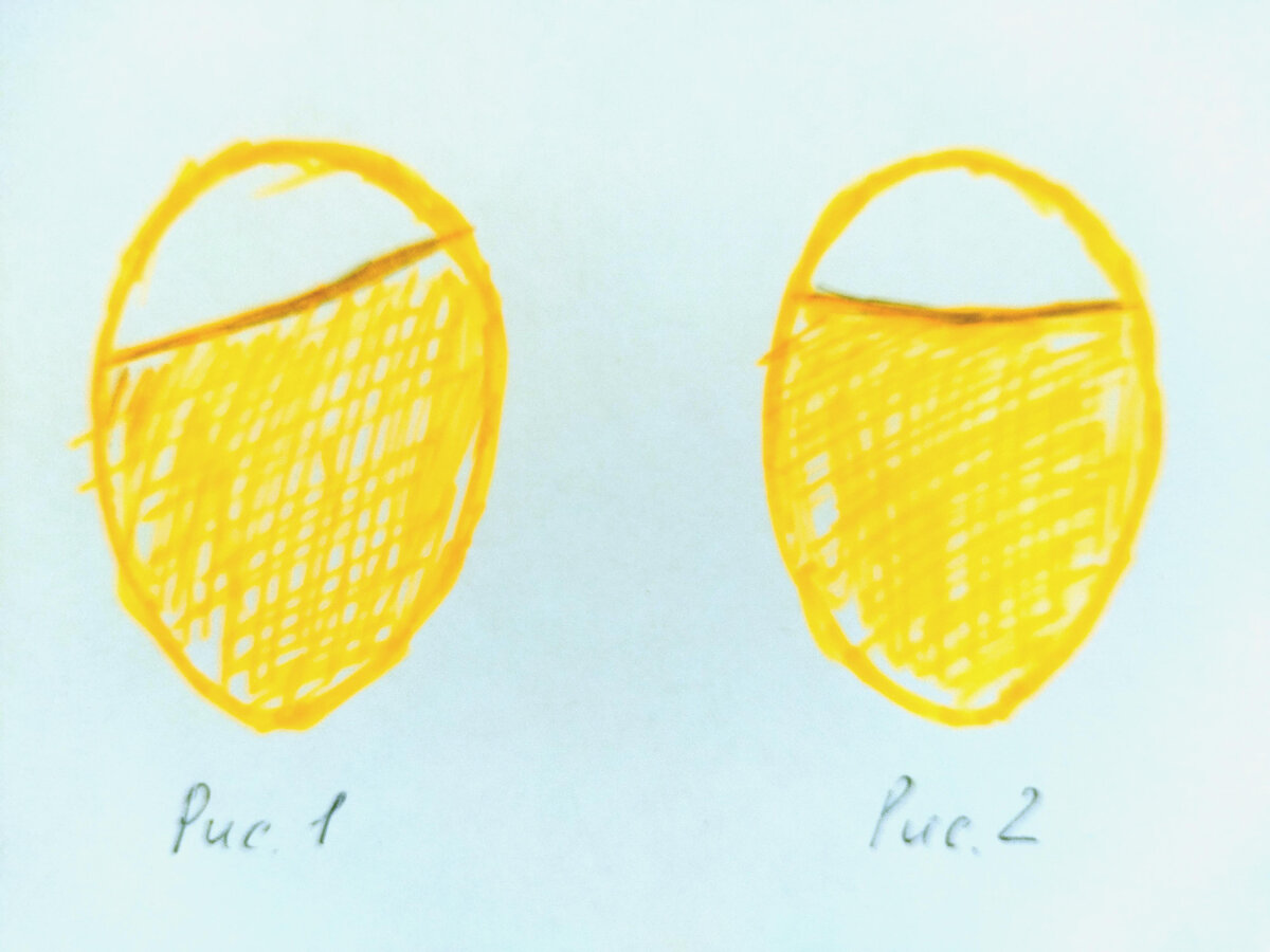 На рисунке 1 воздушная камера размещена с наклоном, следовательно по упомянутой теории, в данном яйце - курочка. На рисунке 2 воздушная камера размещена в центре верхней тупой части яйца и, следовательно, в этом яйце - петушок.