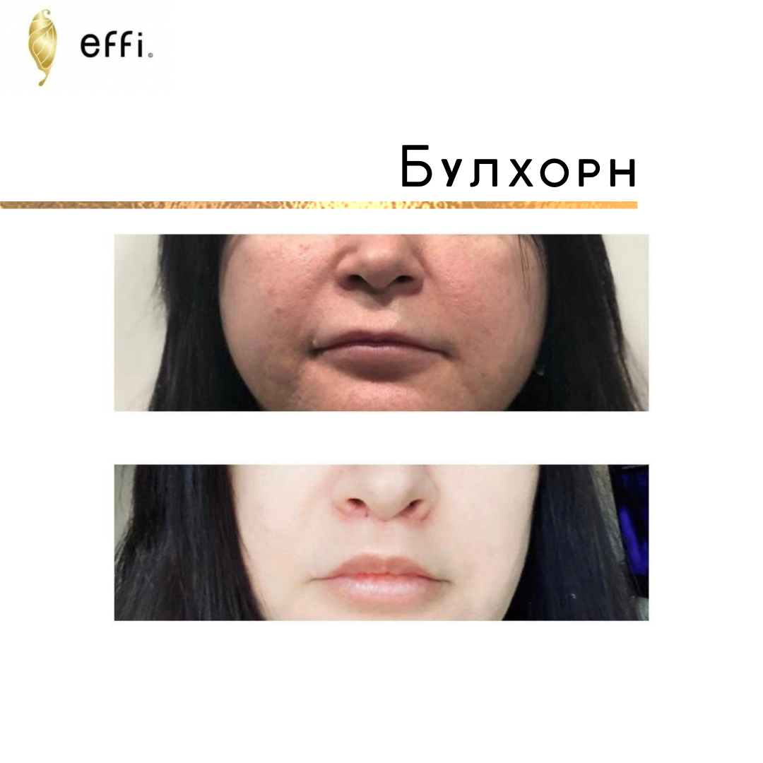 Клиника косметологии и пластической хирургии effi. Красноярск
