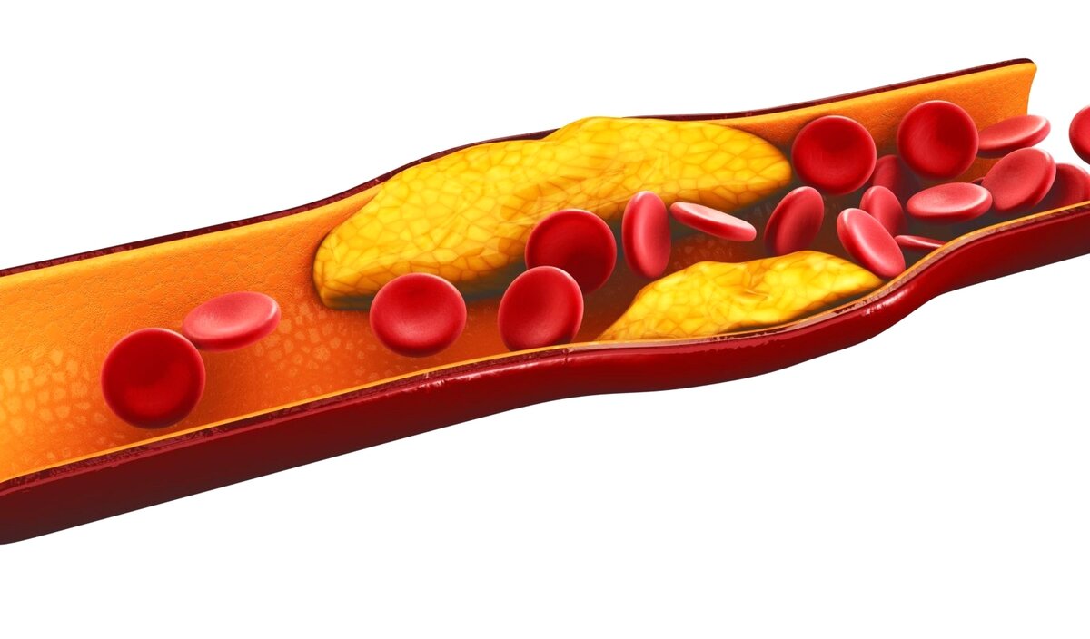 Что такое холестерин и как держать его под контролем