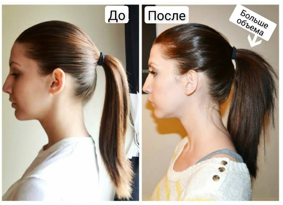 шугаринг рук. носогубный треугольник смерти. электроэпиляция волос на лице. стоит ли убирать волосы. миноксидил 5 % alerana для бороды.