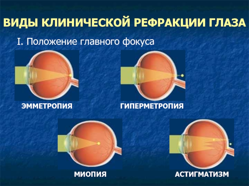 Близорукость и дальнозоркость картинки