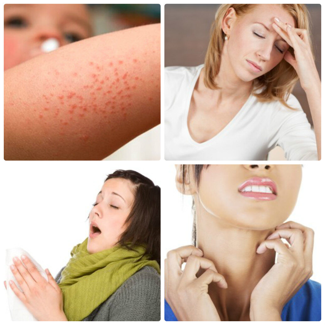 Почему может быть аллергия