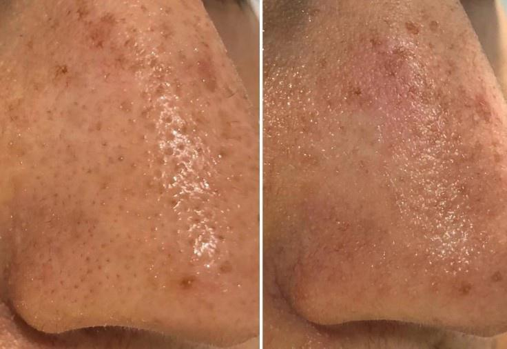 Пример до и после применения набора Lefami