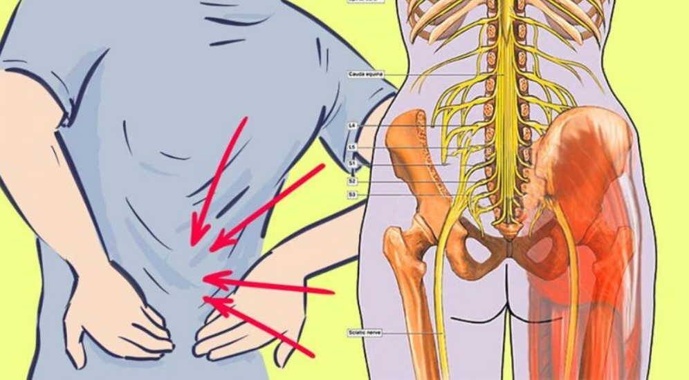 Что происходит при защемлении нерва