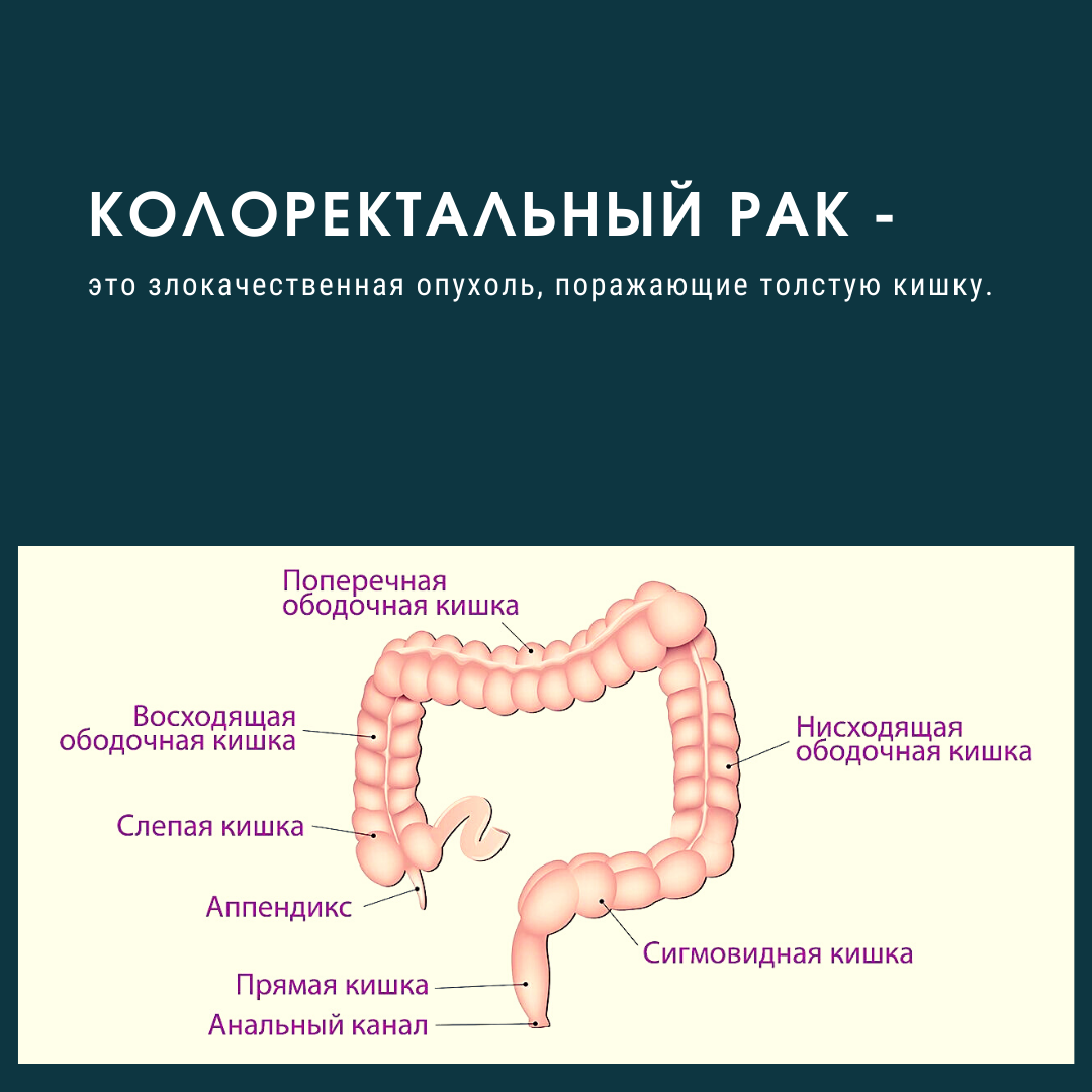 Кишечник к какому врачу обращаться при болях. Ректосигмоидный отдел толстой кишки. Отделы Толстого кишечника. Ректосигмоидном отделе кишечника. Ректосигмоидный отдел толстой.