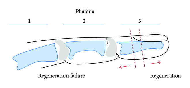 У регенерации есть предел, если ампутация произойдет дальше обозначенной черты, то палец не восстановится.