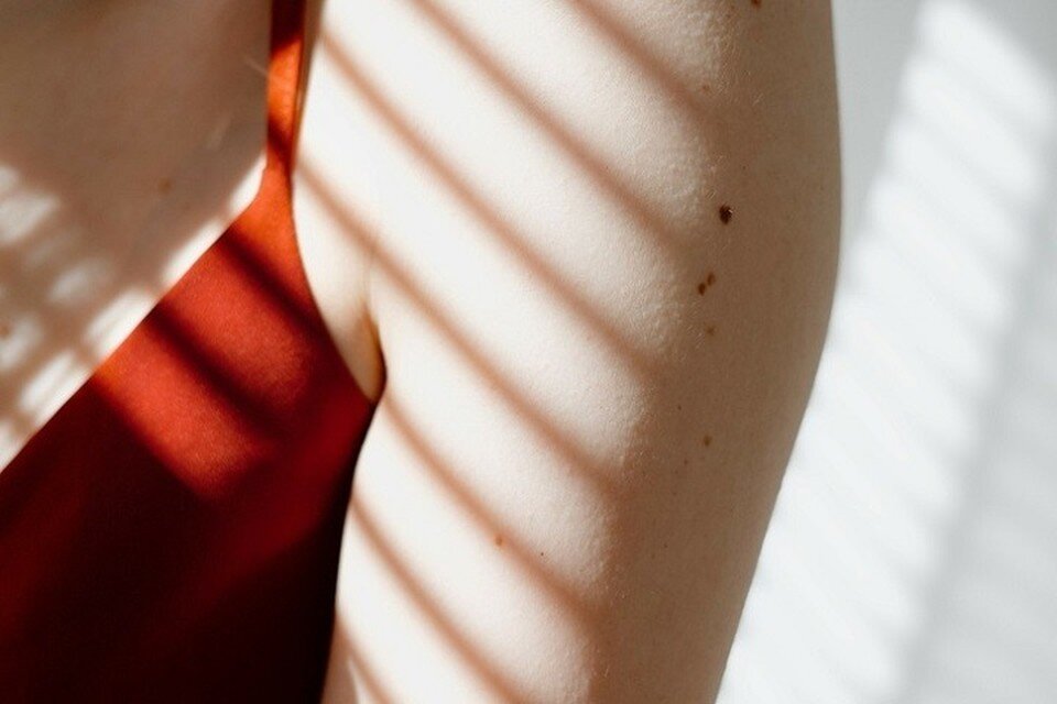     Родинки, которые с нами с рождения, наименее опасны. Фото: архив "КП"