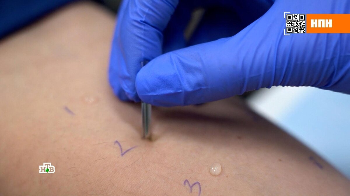    Аллергия: только один метод достоверно помогает справиться с болезнью