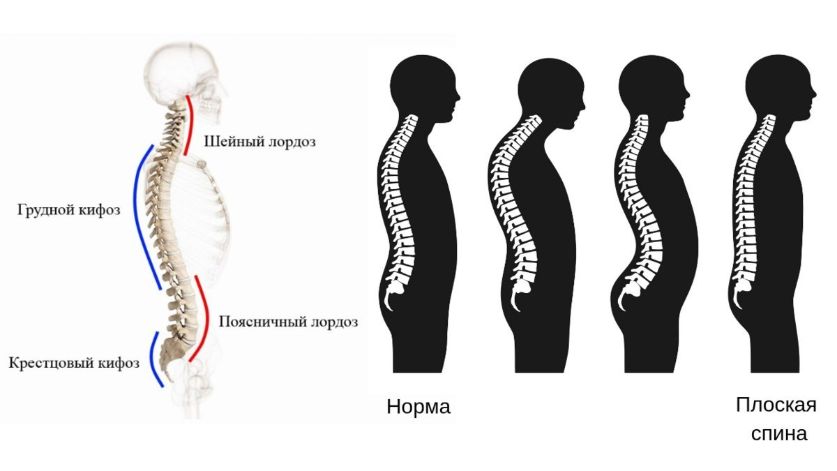 Позвоночник человека лордоз кифоз. Кифоз лордоз грудного отдела позвоночника. Искривление грудного отдела позвоночника кифоз. Изгибы позвоночника лордоз и кифоз.