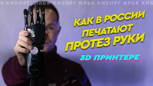 Как в России печатают протезы на 3D принтере