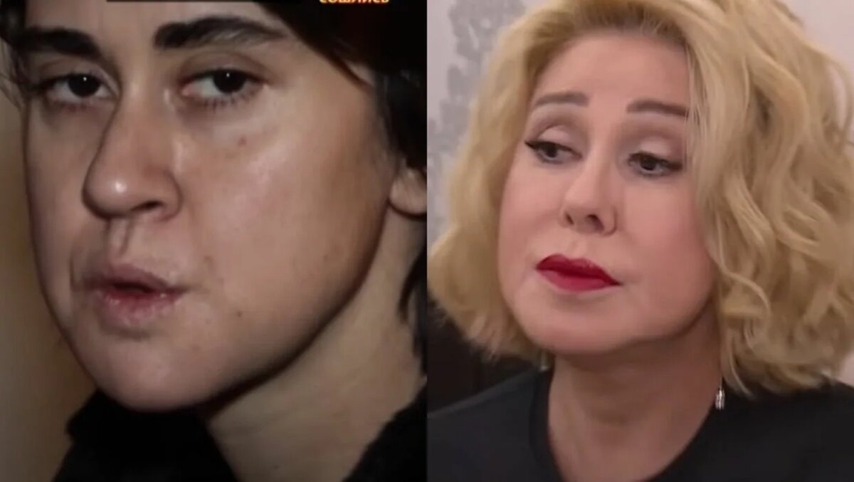 Дочь любови успенской до и после пластики