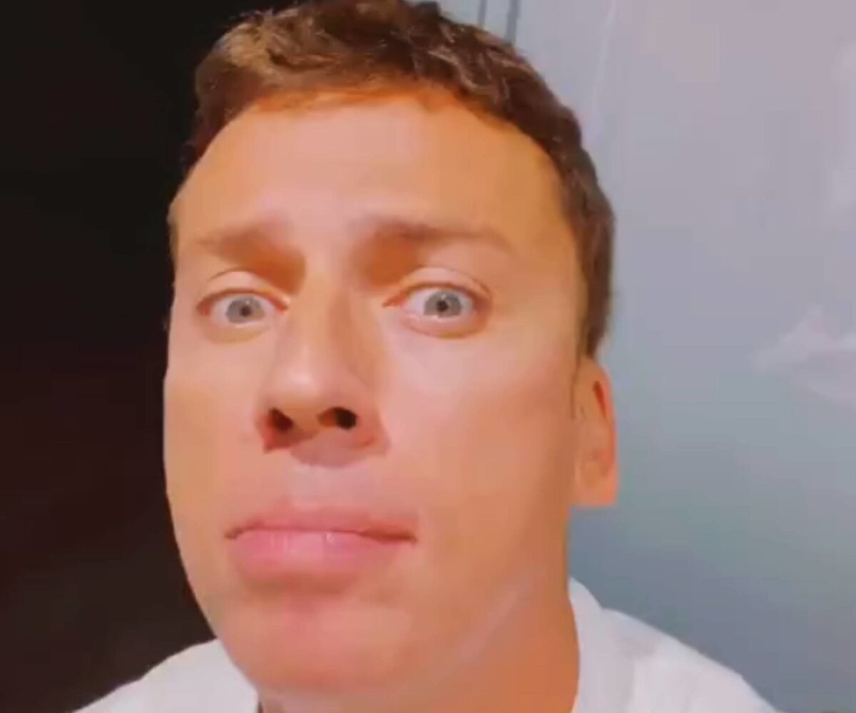     «Дети теперь смеются»: Максим Галкин показал лицо после новости о том, что ему подбили глаз в Израиле