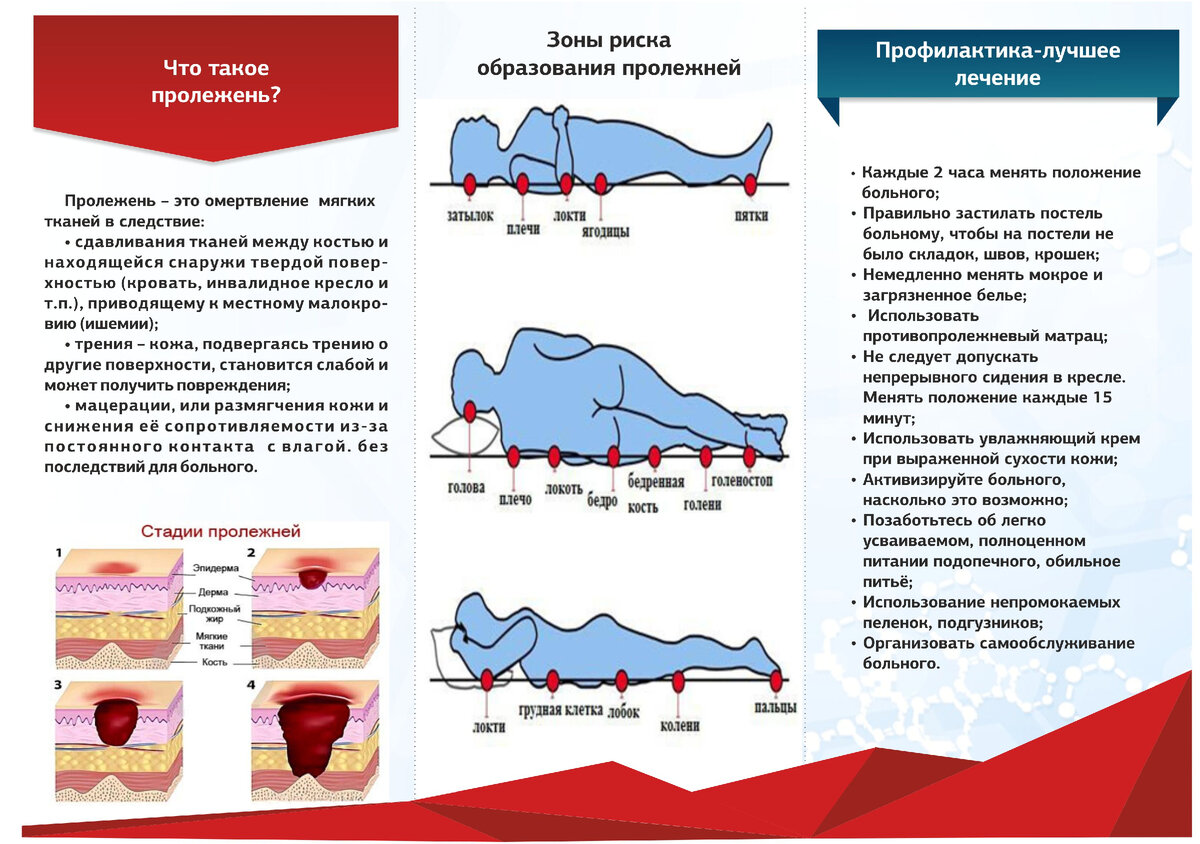 План ухода за тяжелобольным и неподвижным пациентом