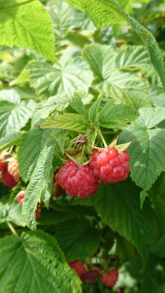 "Зачем меня так зашили?" | Блог акушера | Дзен