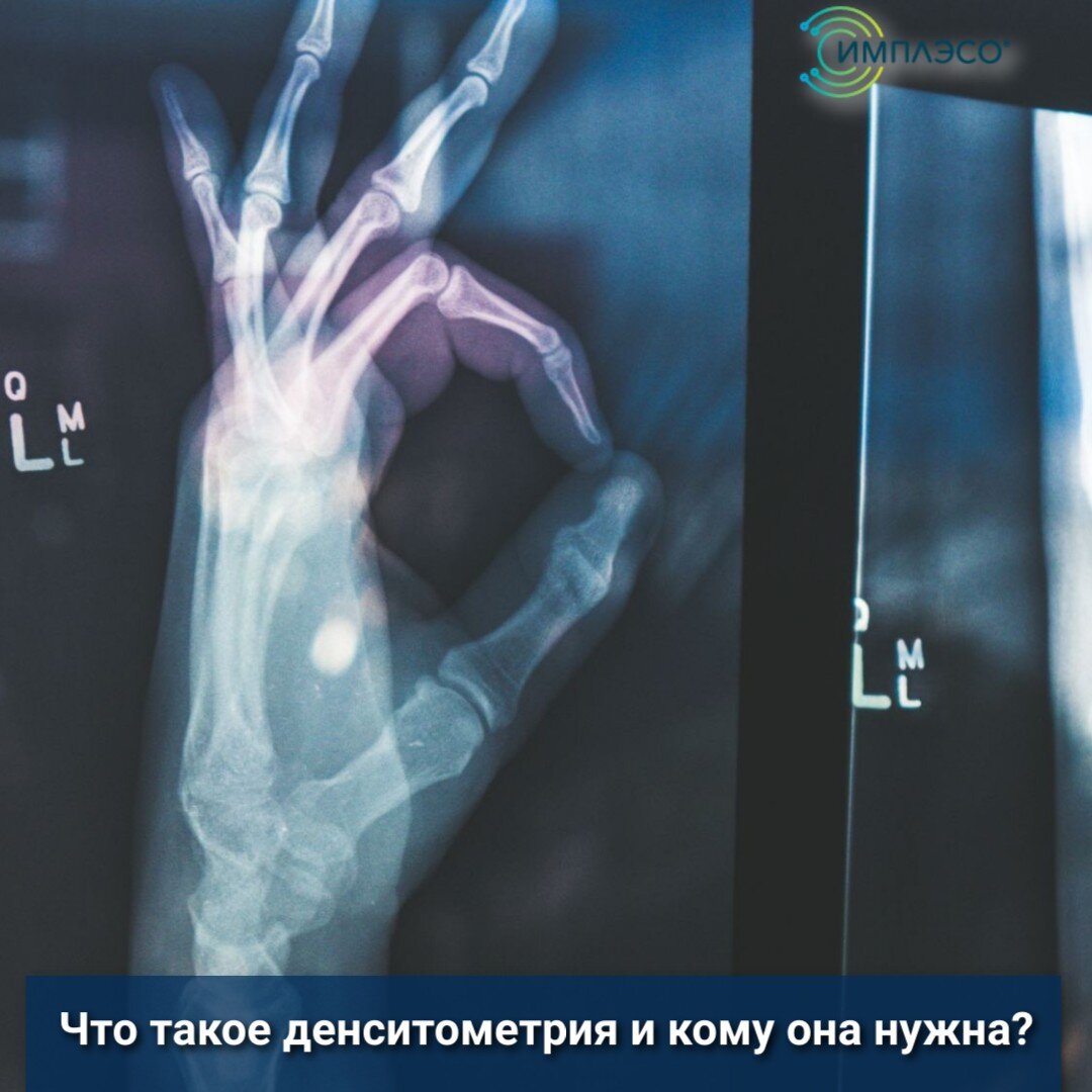Что такое денситометрия и кому она нужна? | ИМПЛЭСО® - лечение артроза ...