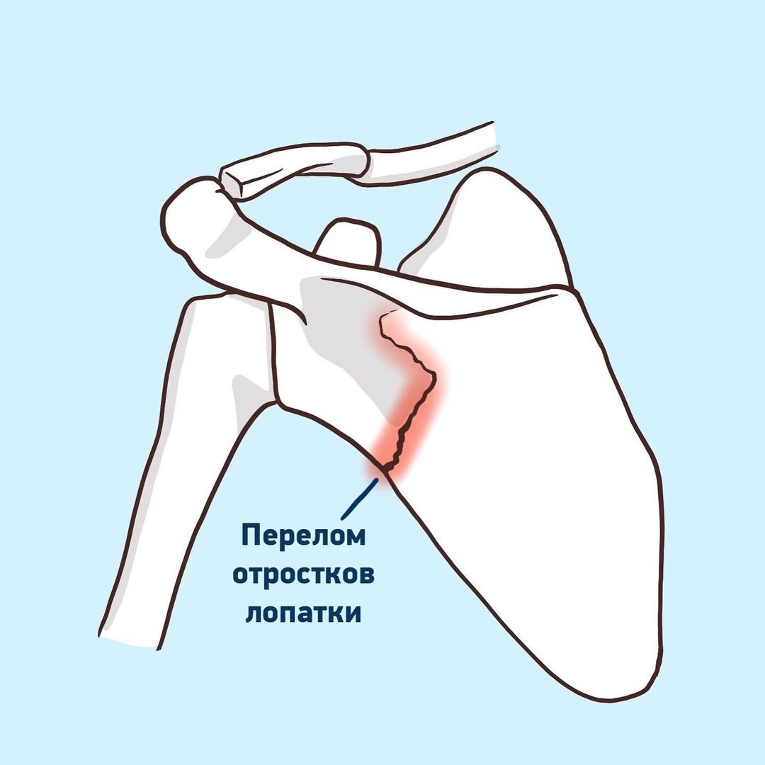 Что делать если рука прилипает к столу при игре