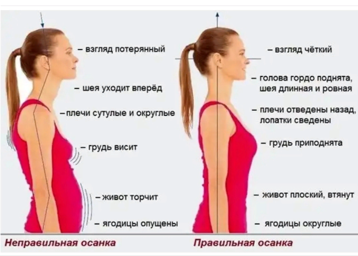 Почему опускается. Сутулая осанка. Правильная осанка шеи. Осанка шея вперед. Правильная и неправильная осанка