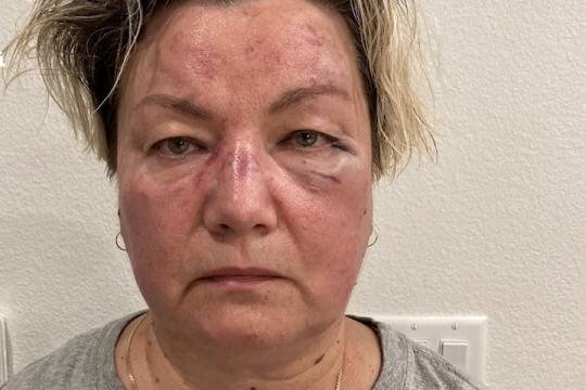    Российскую таксистку избили афроамериканки в Лас-Вегасе