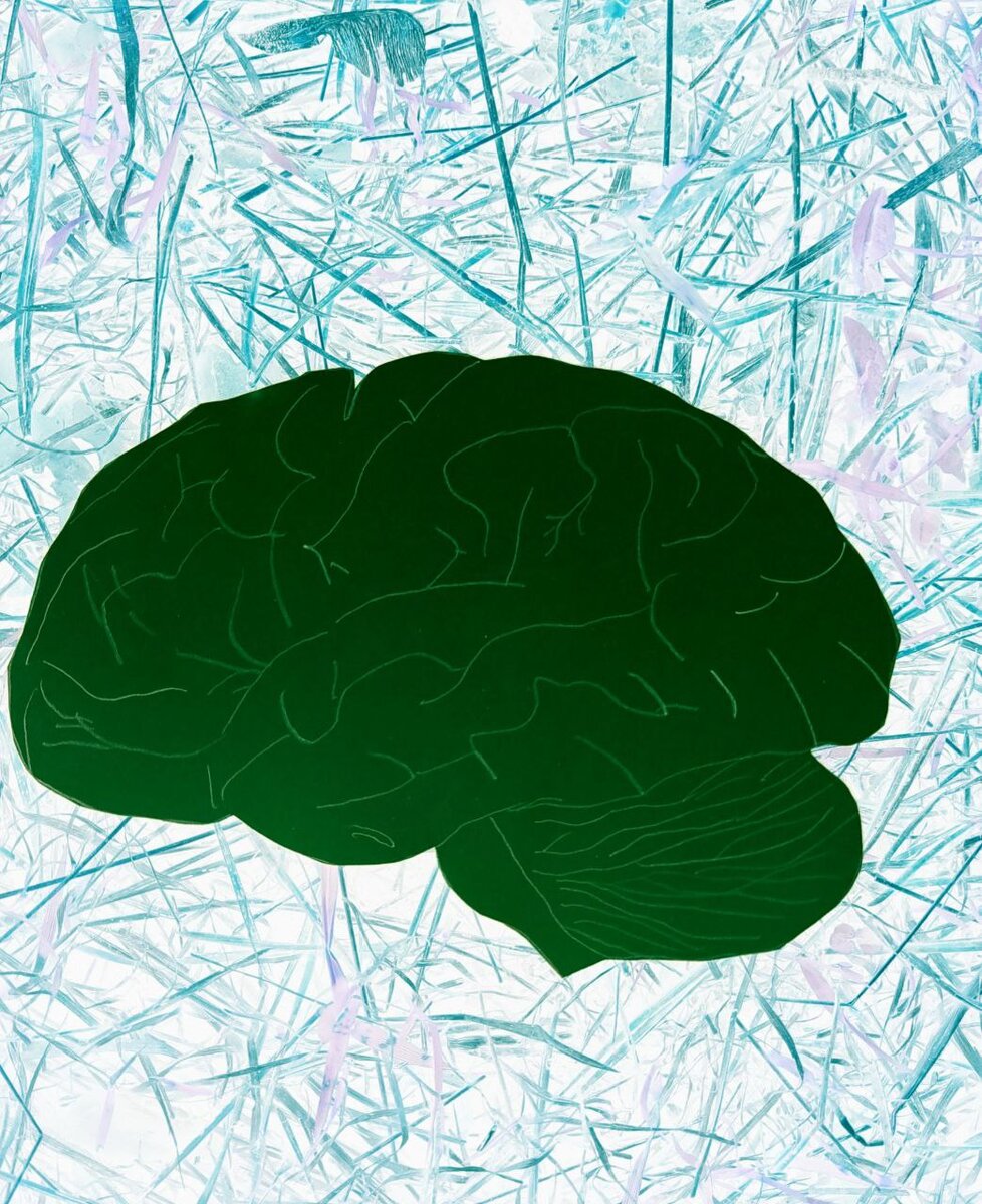 Орган с ассоциативными связями cerebrum